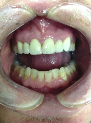 Patient B – after