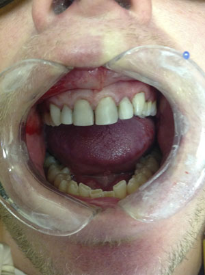 Patient B – before