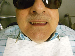 Patient A – before