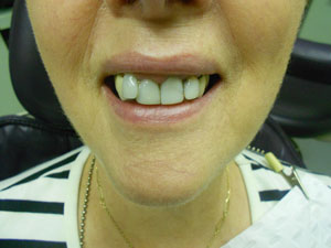 Jean– before