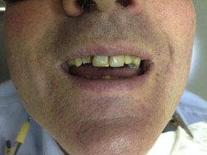 John – before